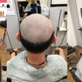 Someone who lose his hair at barber