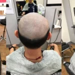 Someone who lose his hair at barber