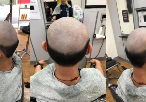 Someone who lose his hair at barber